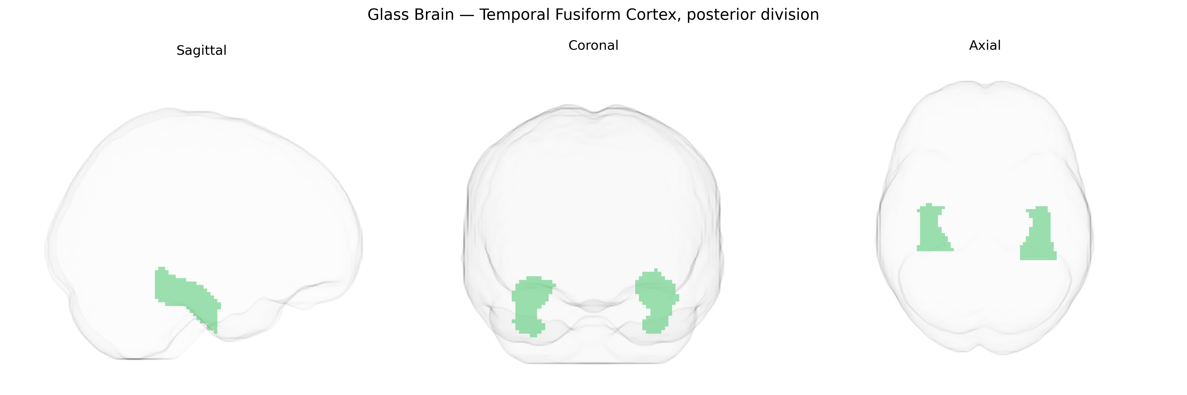 Triplanar Ghost Brain