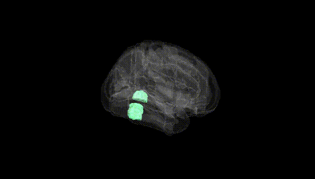 Full Brain Black