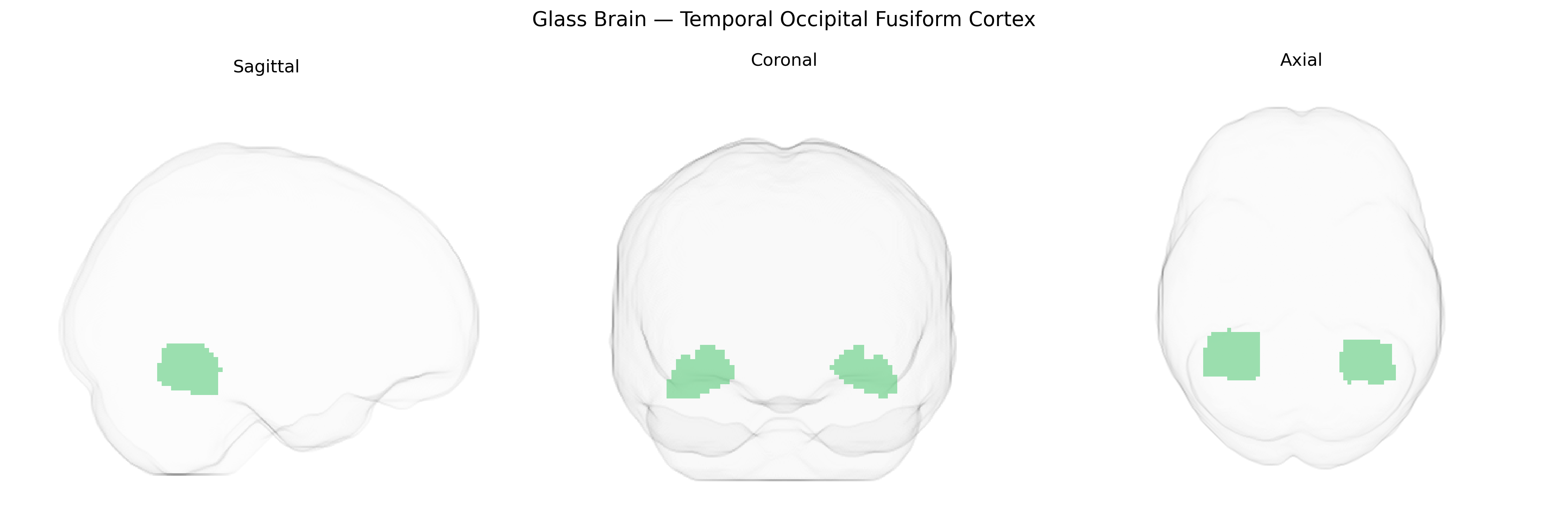 Triplanar Ghost Brain