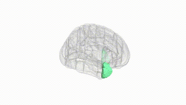 Full Brain White