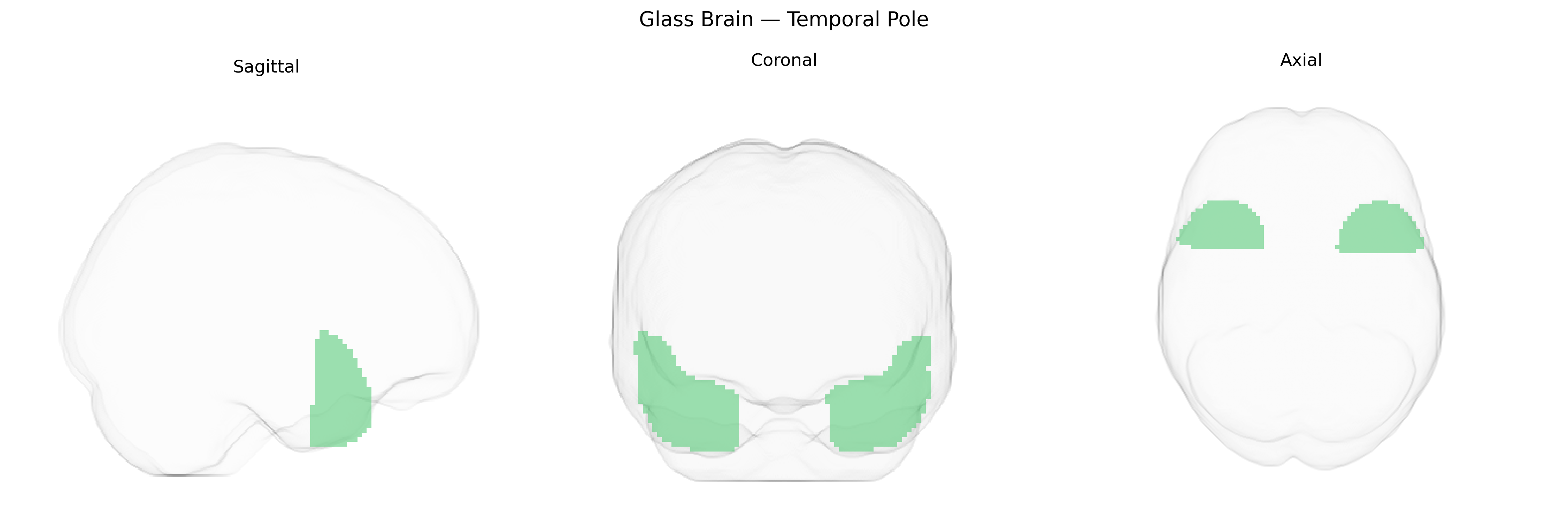 Triplanar Ghost Brain