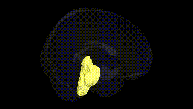 Full Brain Black