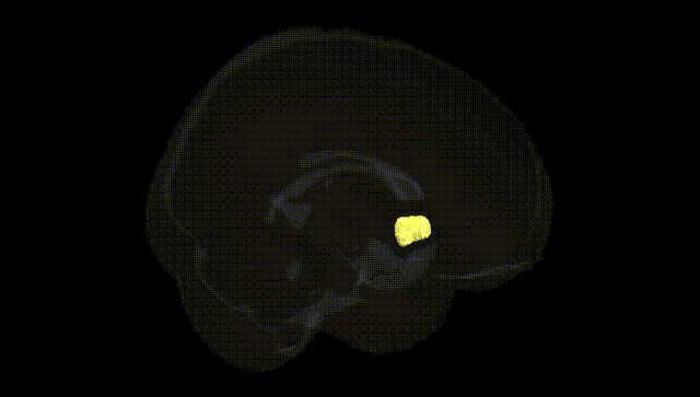 Full Brain Black