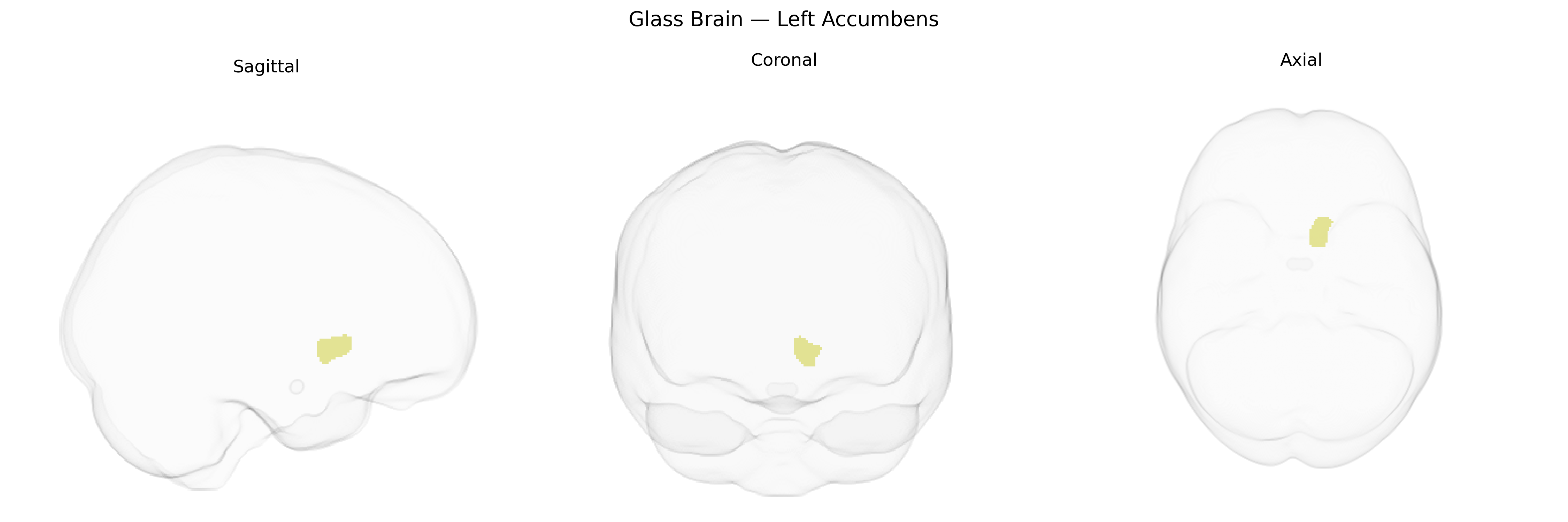 Triplanar Ghost Brain