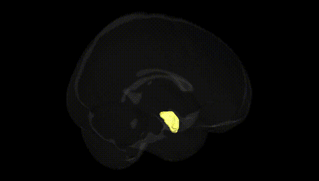 Full Brain Black