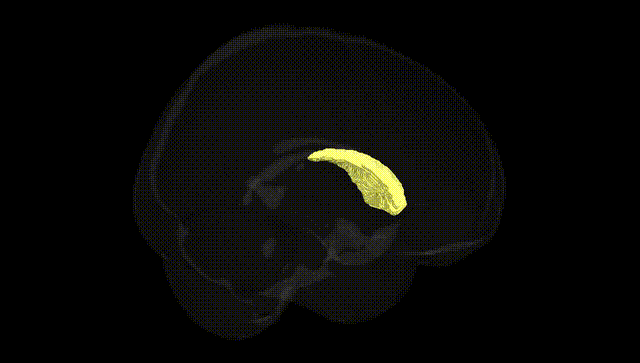 Full Brain Black