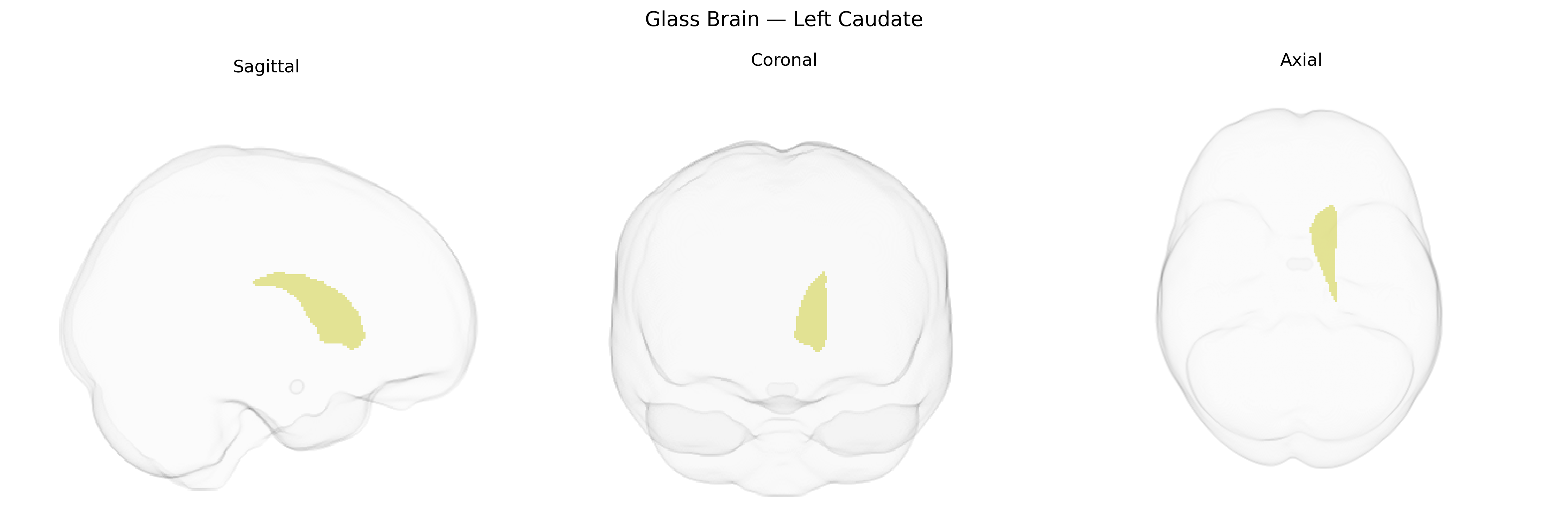 Triplanar Ghost Brain