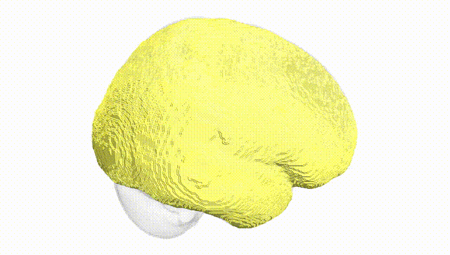 Full Brain White