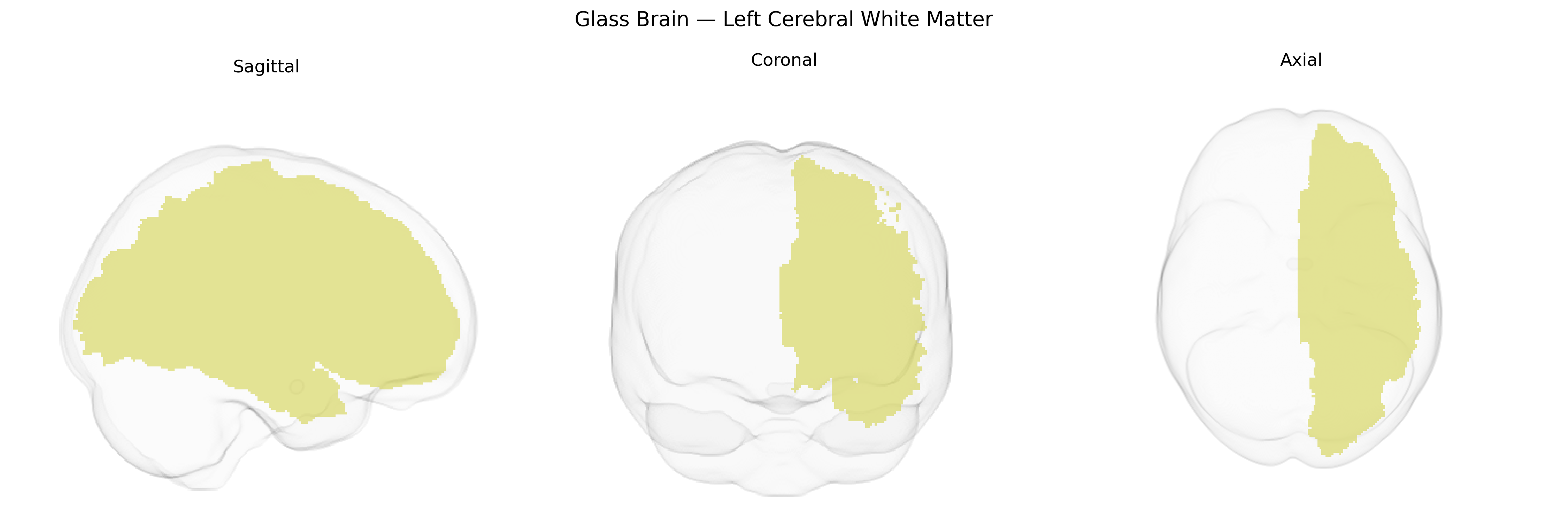 Triplanar Ghost Brain