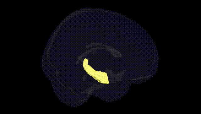 Full Brain Black