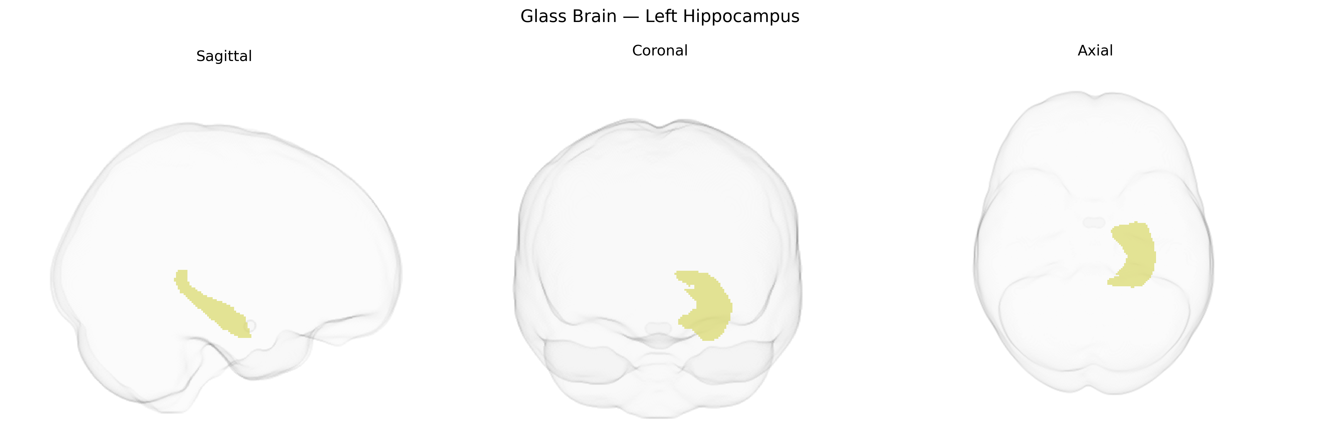 Triplanar Ghost Brain