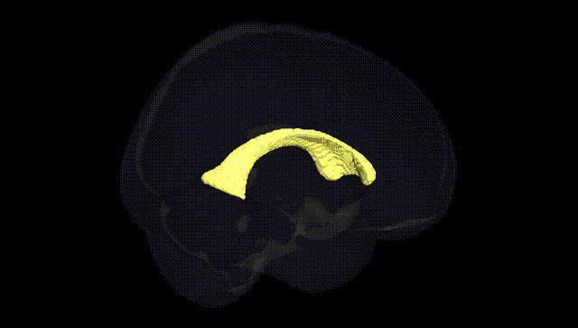 Full Brain Black
