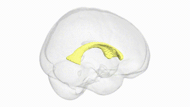 Full Brain White