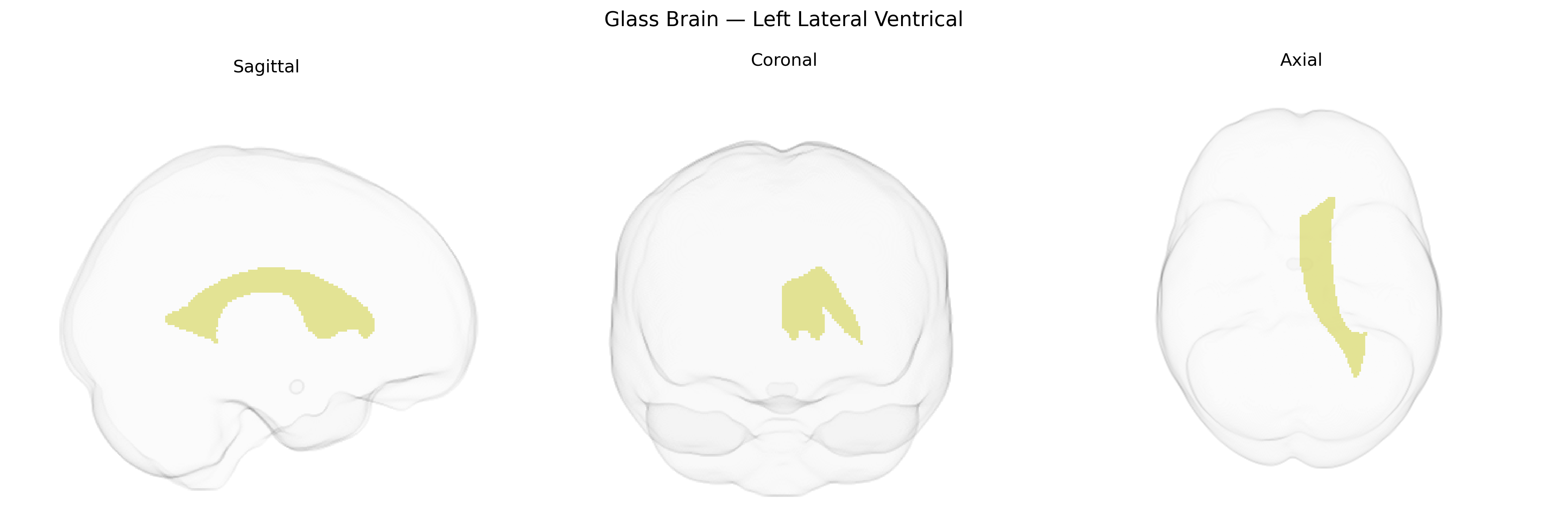 Triplanar Ghost Brain