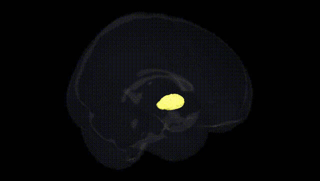 Full Brain Black