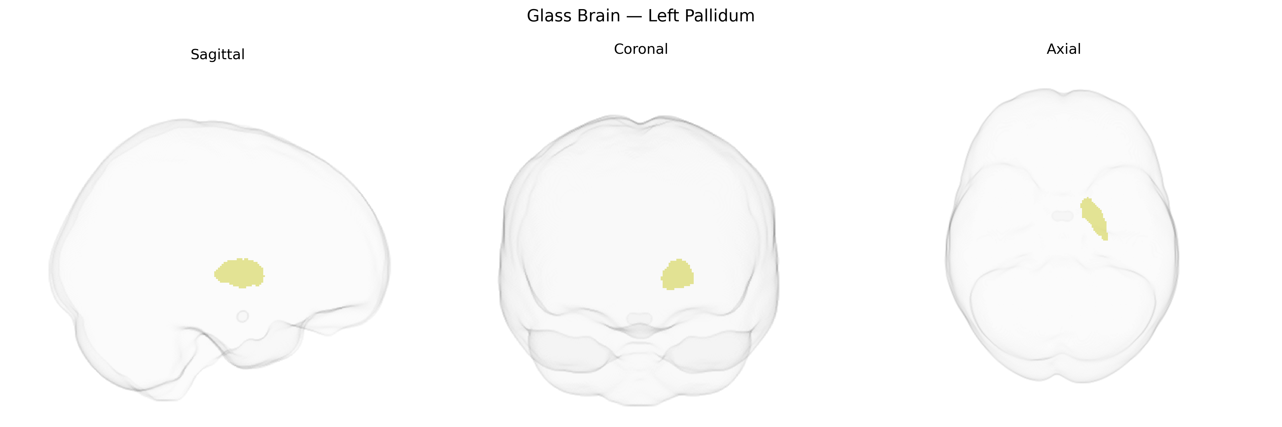 Triplanar Ghost Brain