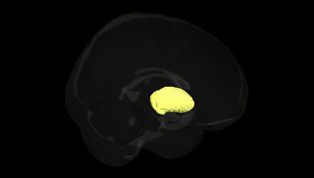 Full Brain Black