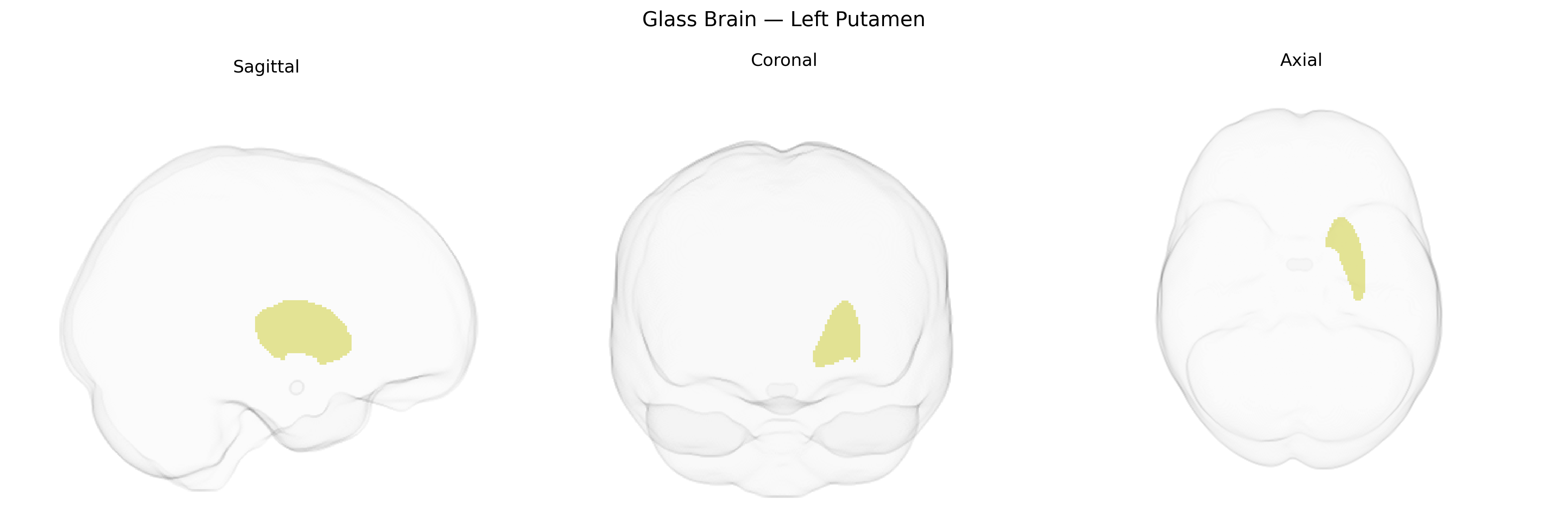Triplanar Ghost Brain