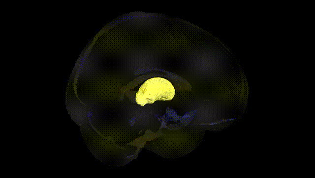 Full Brain Black