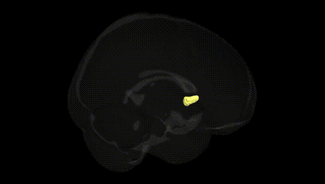 Full Brain Black