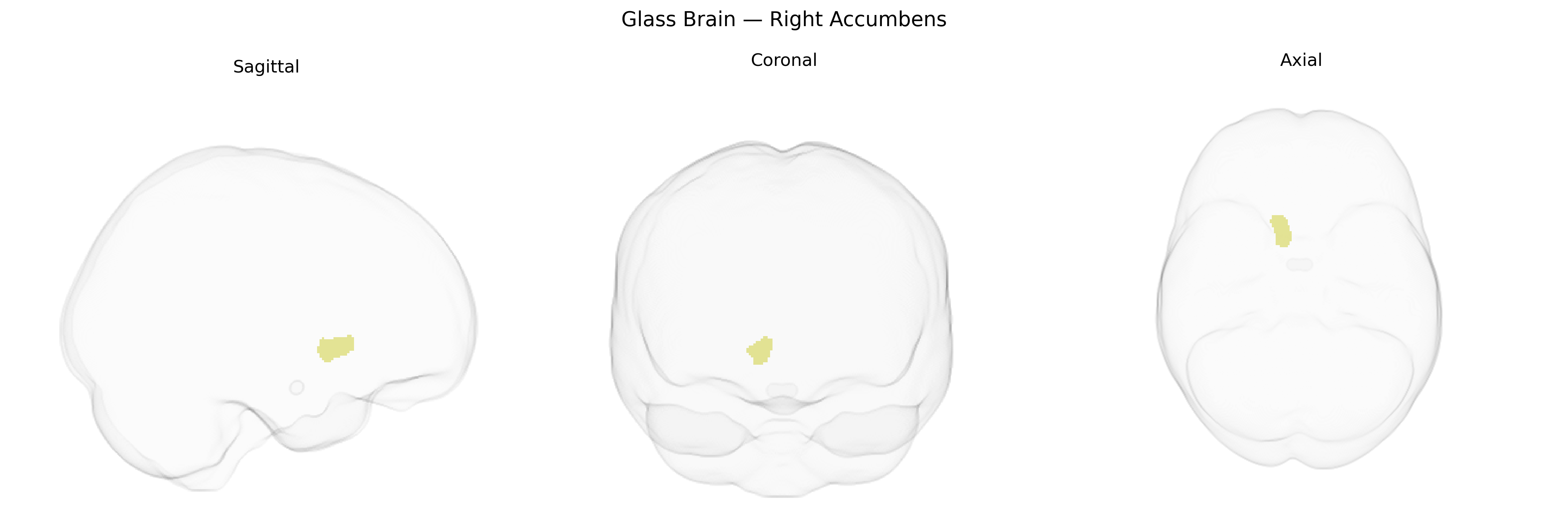 Triplanar Ghost Brain
