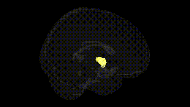Full Brain Black