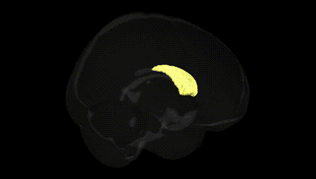 Full Brain Black