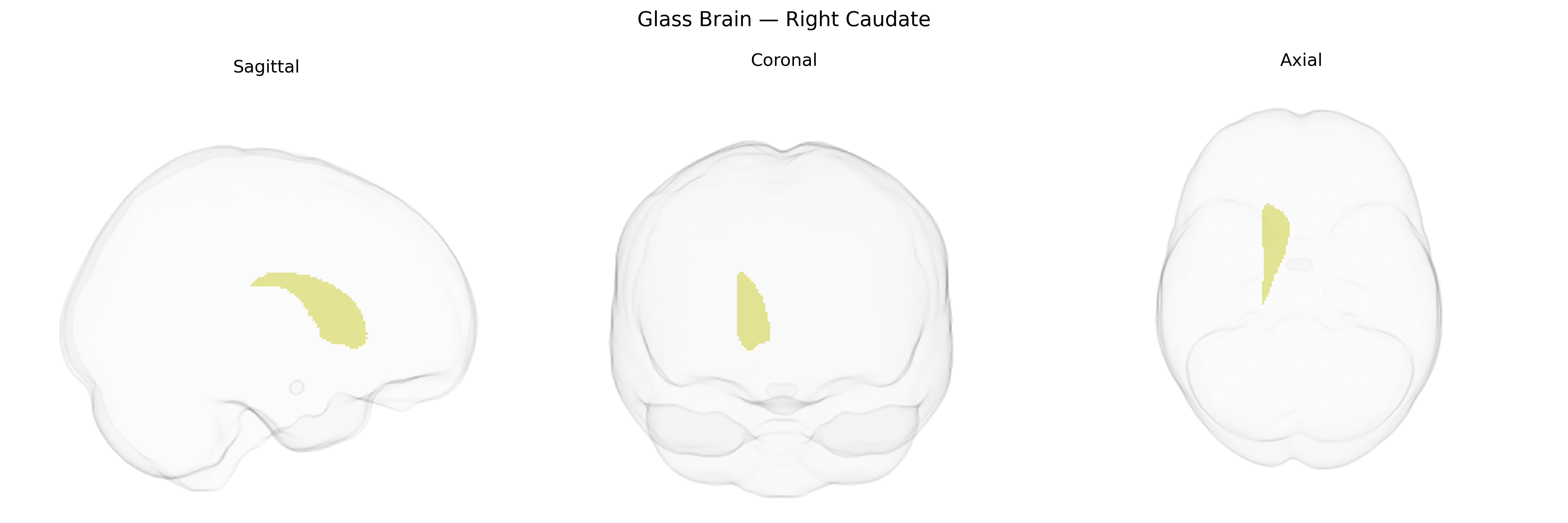 Triplanar Ghost Brain