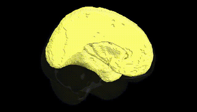 Full Brain Black