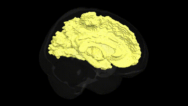 Full Brain Black