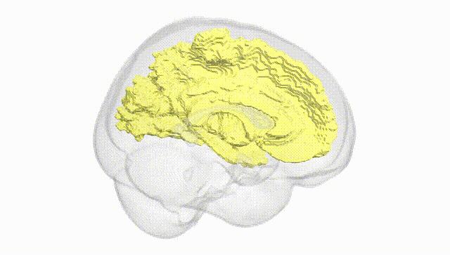 Full Brain White