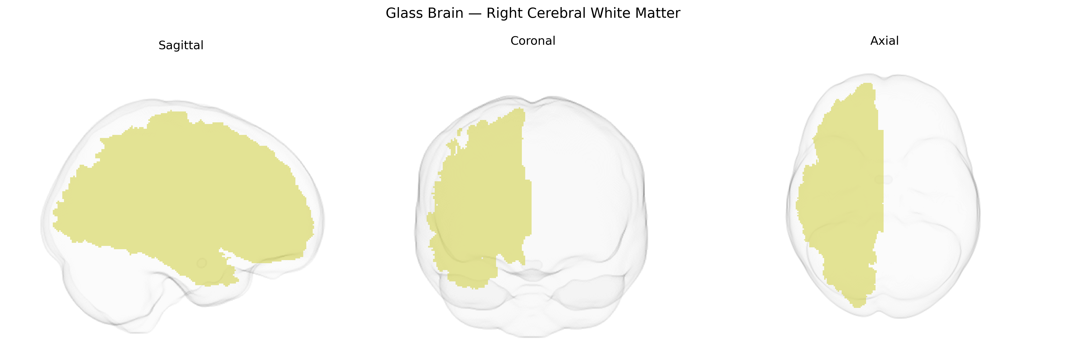 Triplanar Ghost Brain