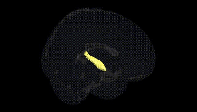 Full Brain Black