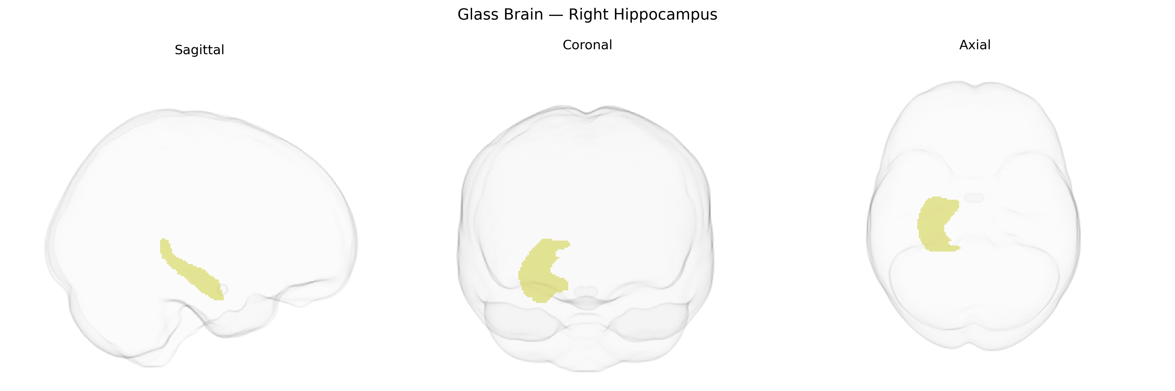 Triplanar Ghost Brain