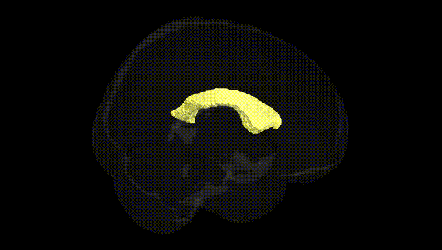 Full Brain Black