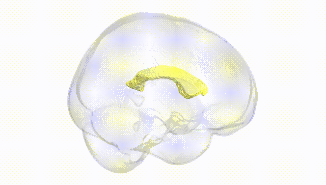 Full Brain White