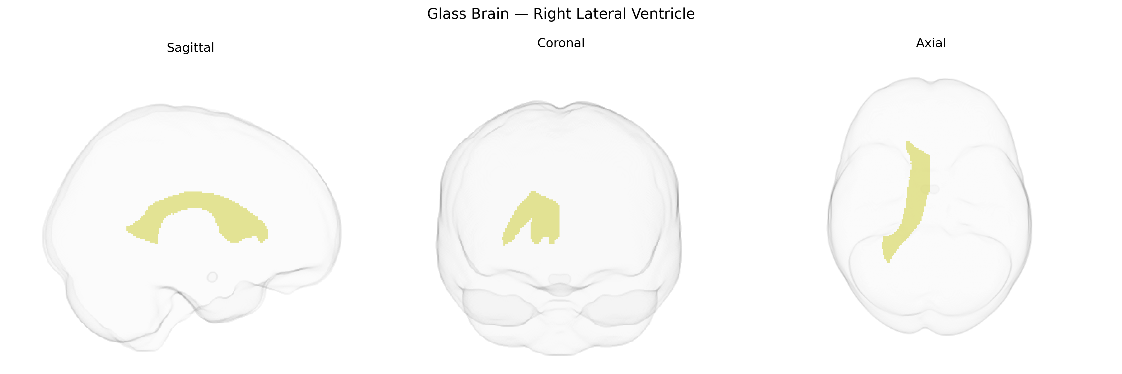 Triplanar Ghost Brain