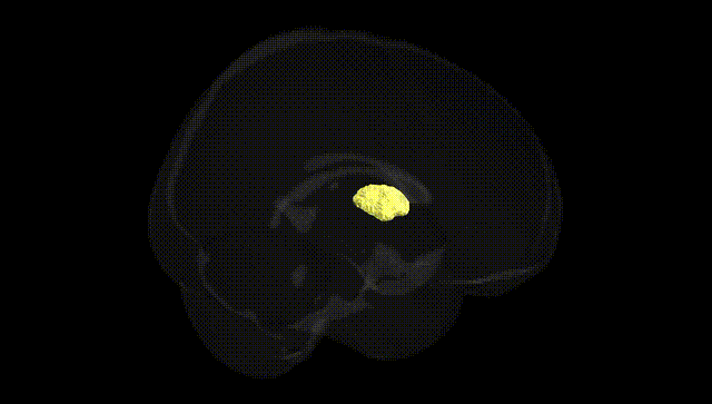 Full Brain Black