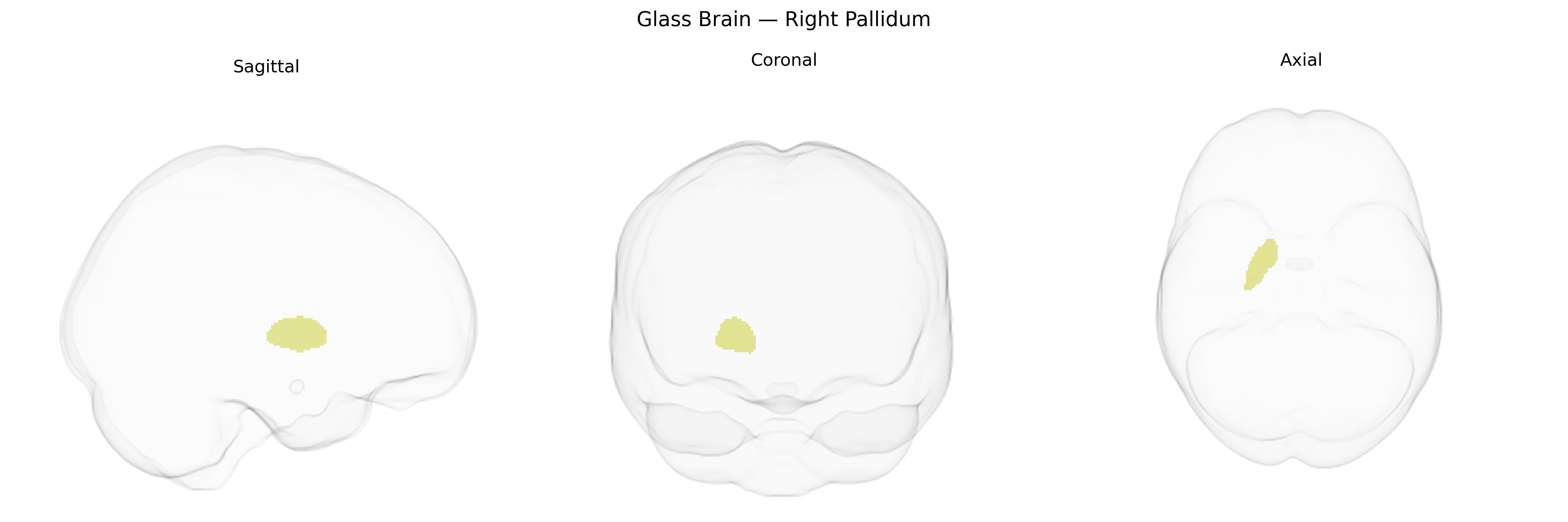 Triplanar Ghost Brain