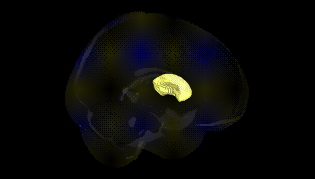 Full Brain Black