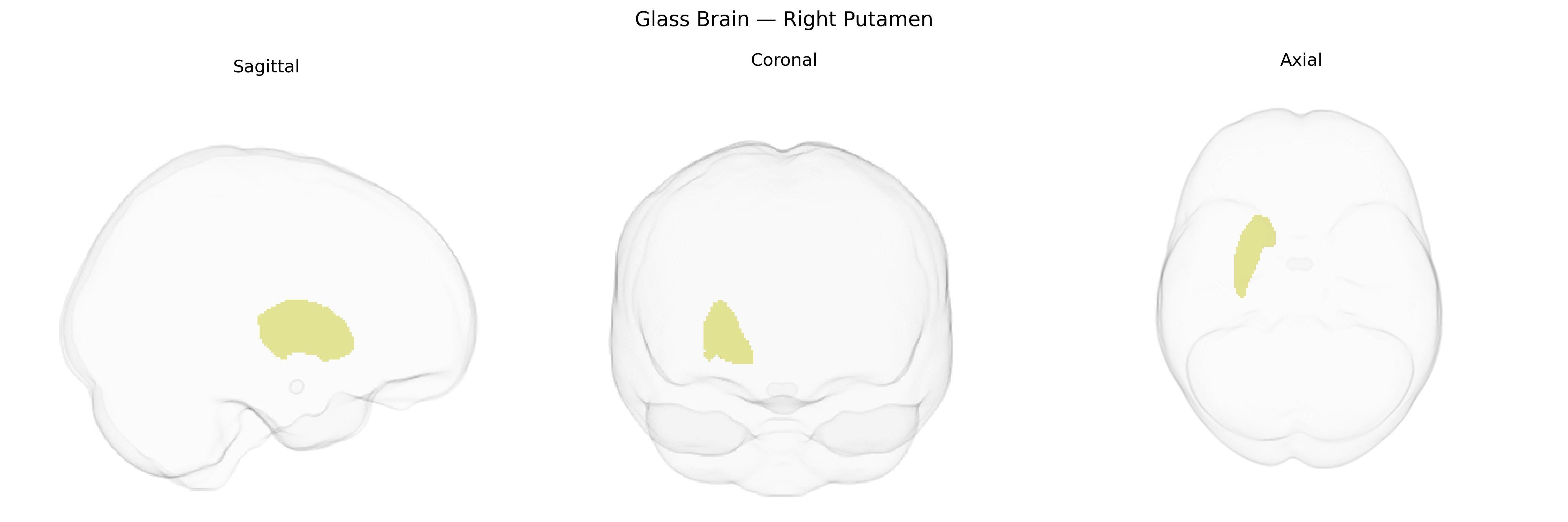 Triplanar Ghost Brain