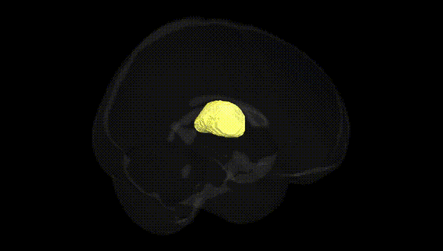 Full Brain Black