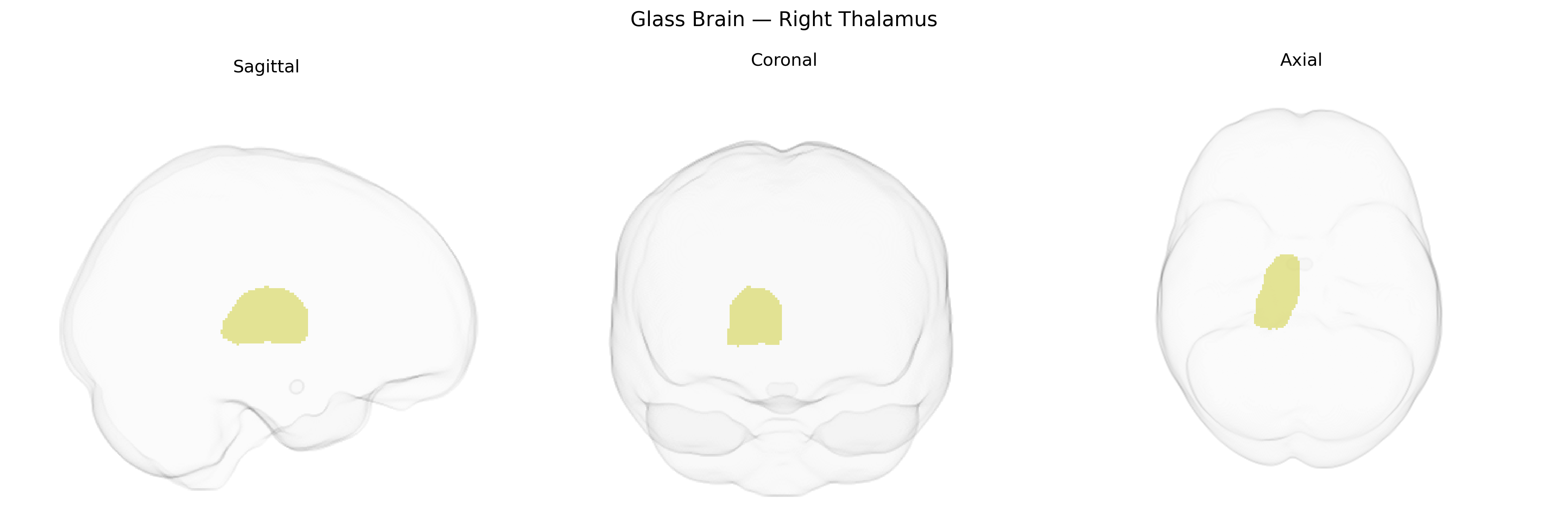Triplanar Ghost Brain