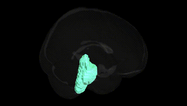 Full Brain Black