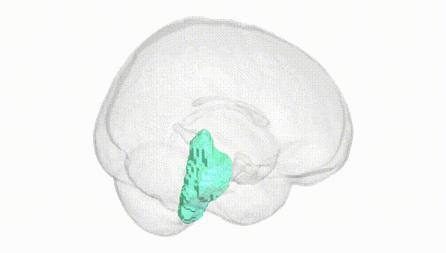 Full Brain White