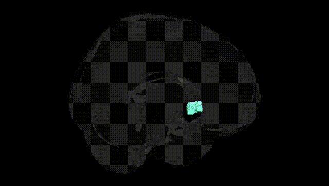 Full Brain Black