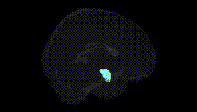 Full Brain Black