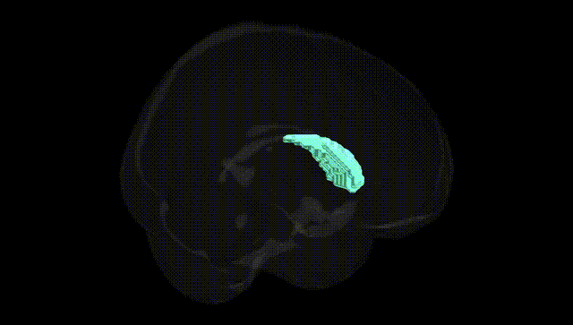 Full Brain Black