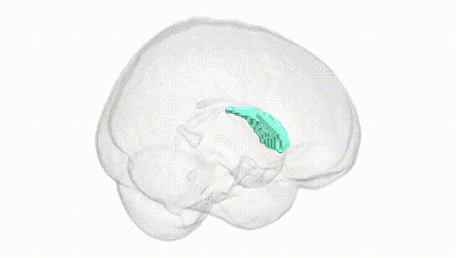 Full Brain White