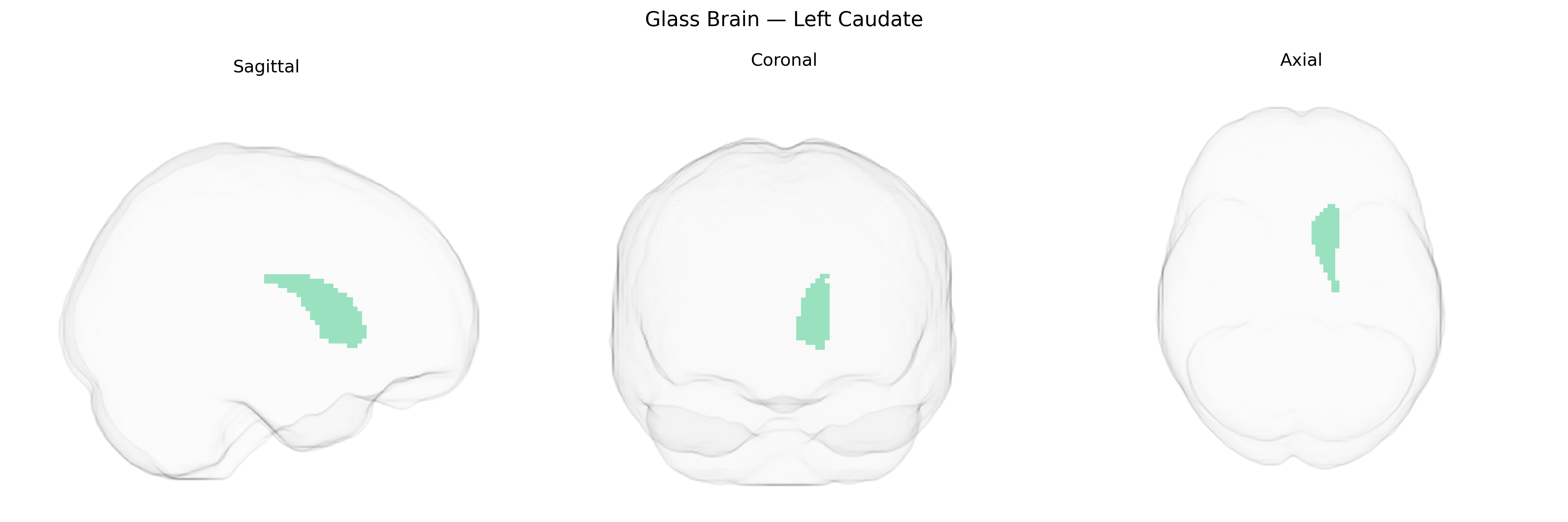 Triplanar Ghost Brain